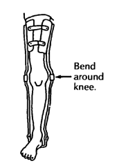 Braces that follow the shape of the leg (Bend around knee,)