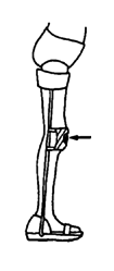 Knee piece that firmly pulls the knee back.