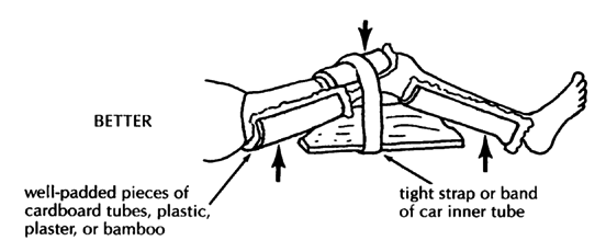 Always use wide areas of pressure.