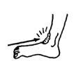 Mmethod of correcting tiptoe contractures.