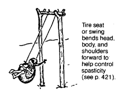 Tire seat or swing bends head. 