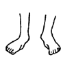 The child's ankles that bend in. 
