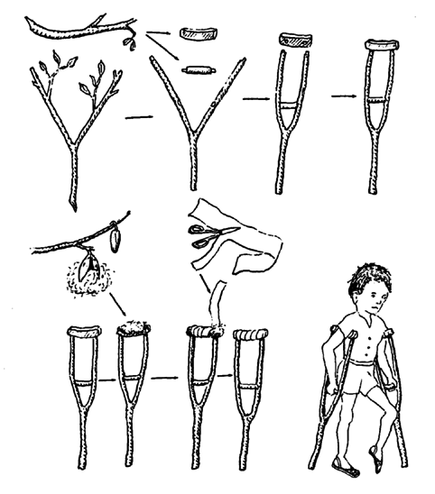 Crutches from tree branches, padded with wild kapok.