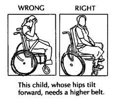 This child, whose hips tilt forward, needs a higher belt (wrong, right)