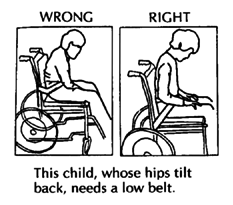 This child, whose hips tilt back, needs a low belt (wrong, right)