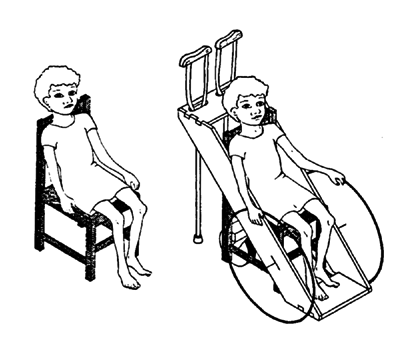 You can make a fairly effective low-cost wheelchair by attaching bicycle wheels or wooden wheels to an ordinary wooden chair.