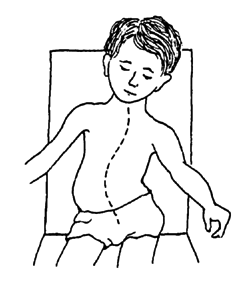The way that the child sits.