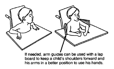 If needed, arm guides can be used with a lap board to keep a child's shoulders forward and his arms in a better position to use his hands.