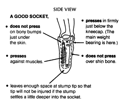 Side view of person's leg.
