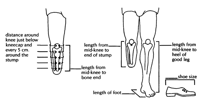 Measurements for a below-knee limb.
