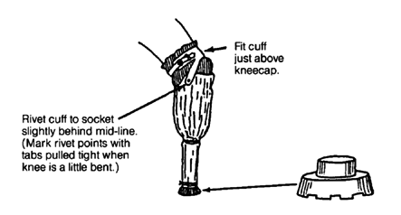 Make a 'cuff' to hold the limb on.