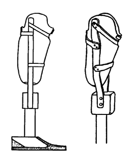  Leather socket: Self-adjusting prosthesis