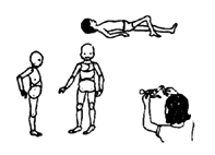 'Flexikins' for measuring contractures and deformities.