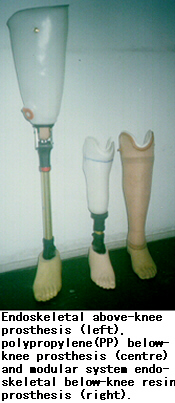 Endoskeletal above-knee prosthesis (left), polypropylene (PP) below-knee prosthesis (centre) and modular system endoskeletal below-knee resin prosthesis (right).