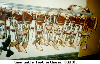 Knee-ankle-foot orthoses (KAFO).