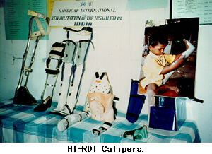 HI-RDI Calipers.