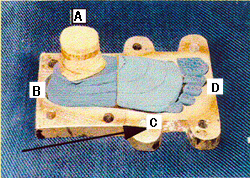 The foundation of the Jaipur Foot.