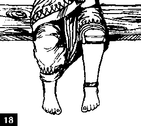 Figure 18. We finished making the Mukti limb.