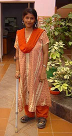 手術後：杖を使いながらも両足で立つハミダさん