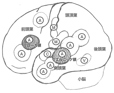 図１　言語に関する左大脳の機能局在