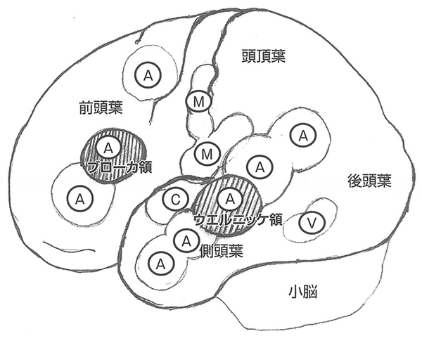 図1　言語に関する左大脳の機能局在