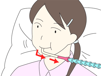 呼気式（吸気式）入力装置のイラスト