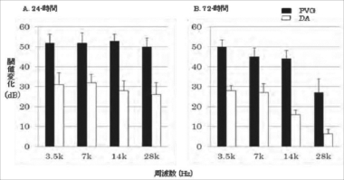 図1　騒音曝露の24時間および72時間後におけるABR閾値変化