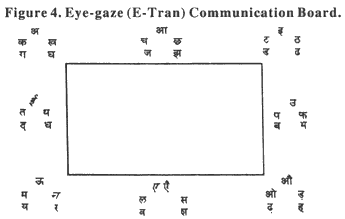 Figure 4. Eye-gaze (E-Tran)