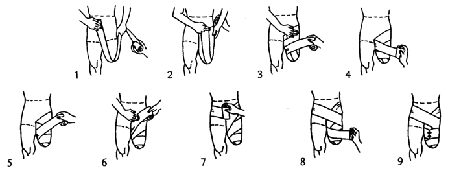 Above knee (1-9)