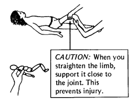When you straighten the limb, support it close to the joint. This prevents injury.