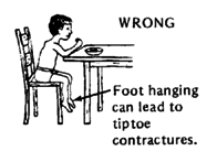 WRONG : Foot hanging can lead to tiptoe contractures.
