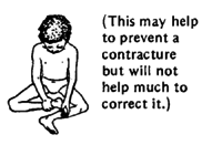  (This may help to prevent a contracture but will not help much to correct it.)
