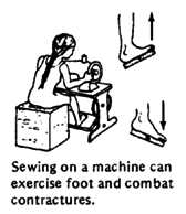 Sewing on a machine can exercise foot and combat contractures.