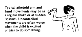 Typical athetoid arm and hand movements may be as a regular shake or as sudden 'spasms'. Uncontrolled movements are often worse when the child is excited or tries to do something.