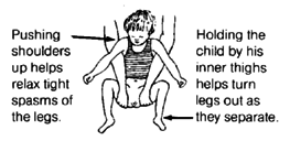 Pushing shoulders up helps relax tight spasms of the legs. Holding the child by his inner thighs helps turn legs out as they separate.