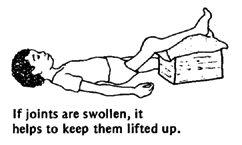 If joints are swollen, it helps to keep them lifted up.