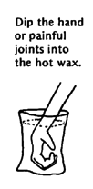 Dip the hand or painful joints into the hot wax.