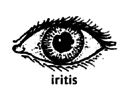 An eys (iritis).