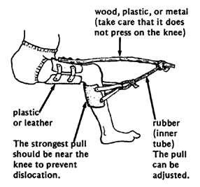Knee method 2.