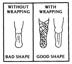 Wrapping the stump (with & without wrapping)