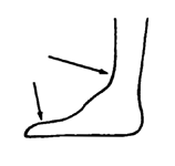 A brace with wide sides at the ankle and foot.