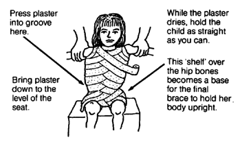 Cast the child's body.